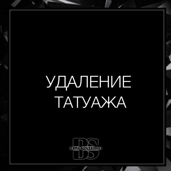 УДАЛЕНИЕ ТАТУАЖА